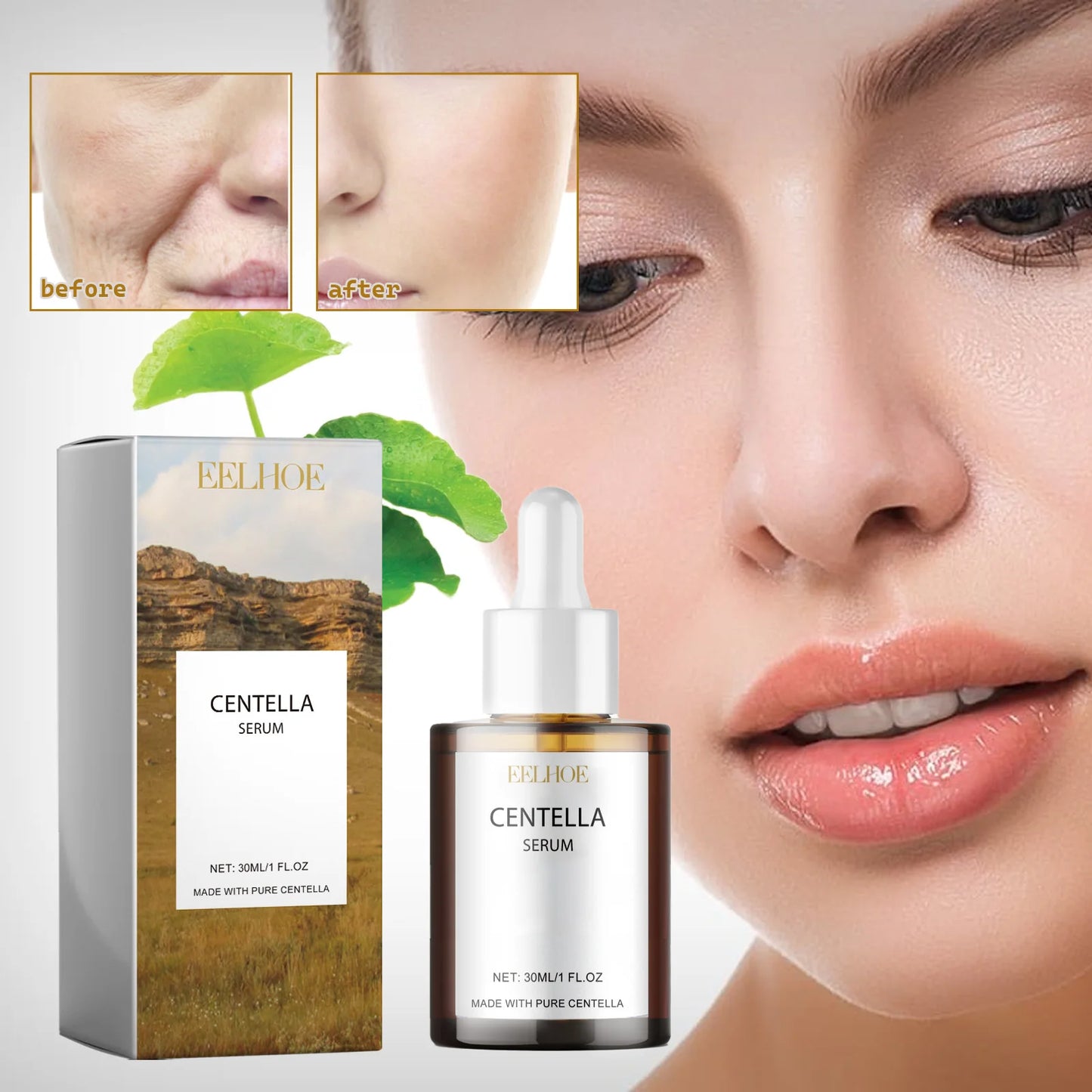 Eelhoe Centella Asiatica Skin Serum For Deep Moisturizing And Repair