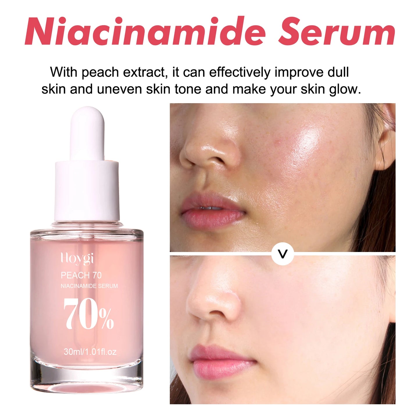 Hoygi Peach Niacinamide Essence Brightening Hydrating Serum
