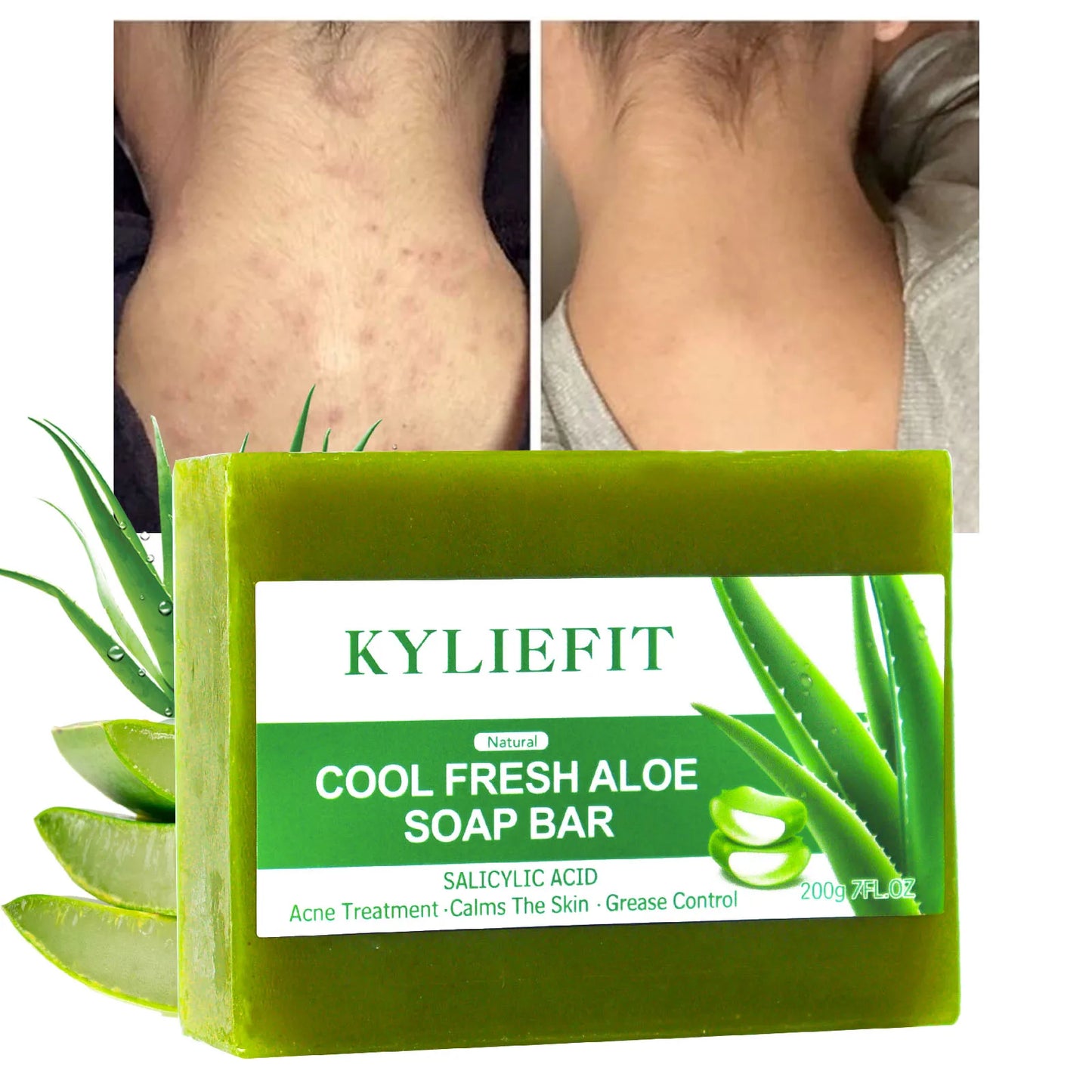 AILKE Aloe Vera Soap All Skin Types Brightening Acne